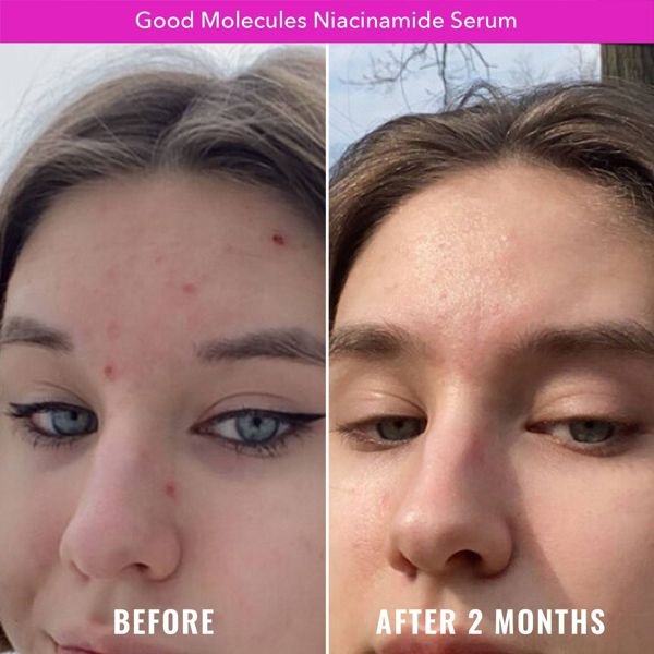 Good Molecules Niacinamide Face Serum - 1 fl oz