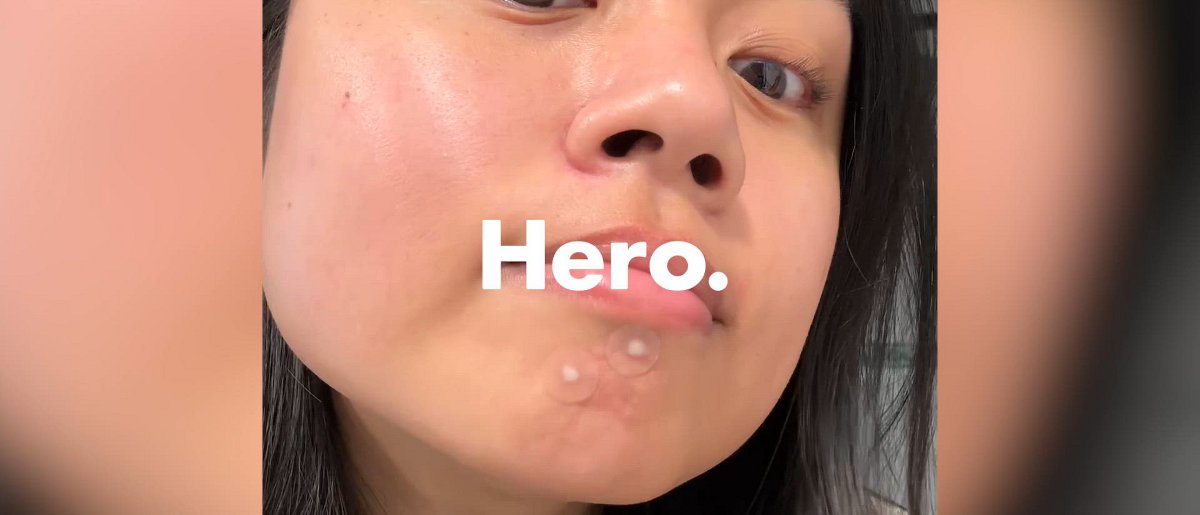 Hero Cosmetics Mighty Patch Original Acne Pimple Patches - 24 Count