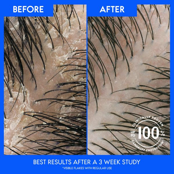Head & Shoulders Dandruff Shampoo, Anti-Dandruff Treatment, Deep Scalp Cleanse for Daily Use, Paraben Free - 12.5 fl oz